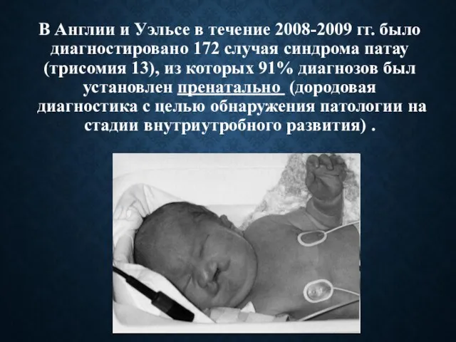 В Англии и Уэльсе в течение 2008-2009 гг. было диагностировано