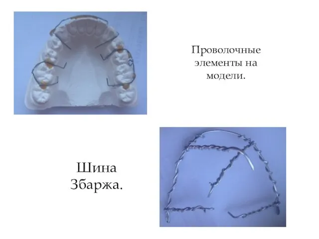 Проволочные элементы на модели. Шина Збаржа.