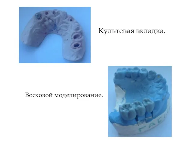 Культевая вкладка. Восковой моделирование.