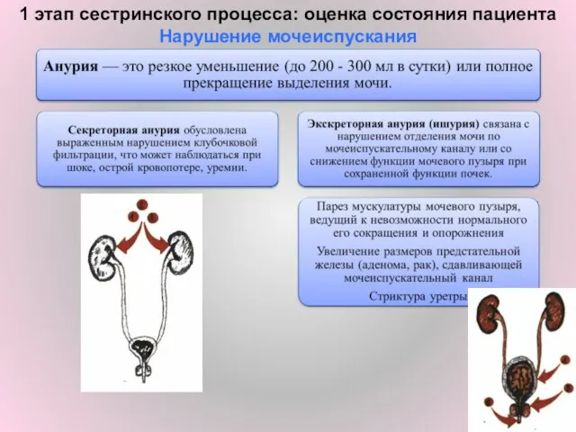 1 этап сестринского процесса: оценка состояния пациента Нарушение мочеиспускания