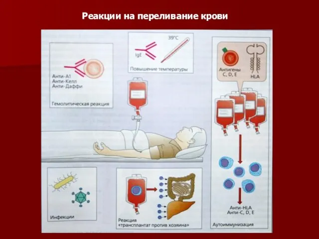 Реакции на переливание крови
