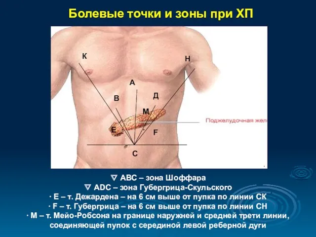 Болевые точки и зоны при ХП ∇ АВС – зона