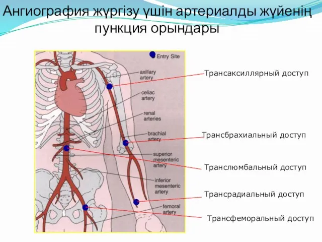 Ангиография жүргізу үшін артериалды жүйенің пункция орындары ● ● ● ● ● Трансаксиллярный