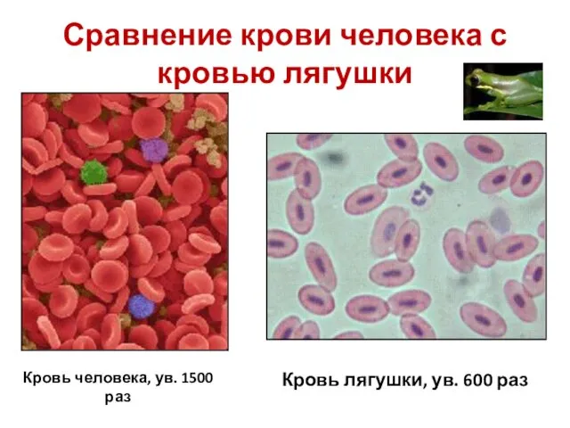 Сравнение крови человека с кровью лягушки Кровь человека, ув. 1500 раз Кровь лягушки, ув. 600 раз