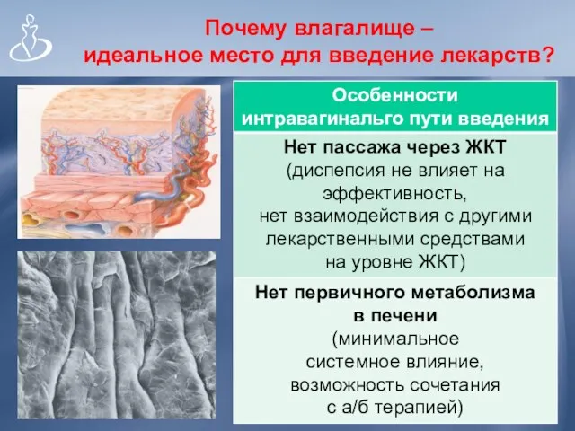 Почему влагалище – идеальное место для введение лекарств? Слизистая тонкая,