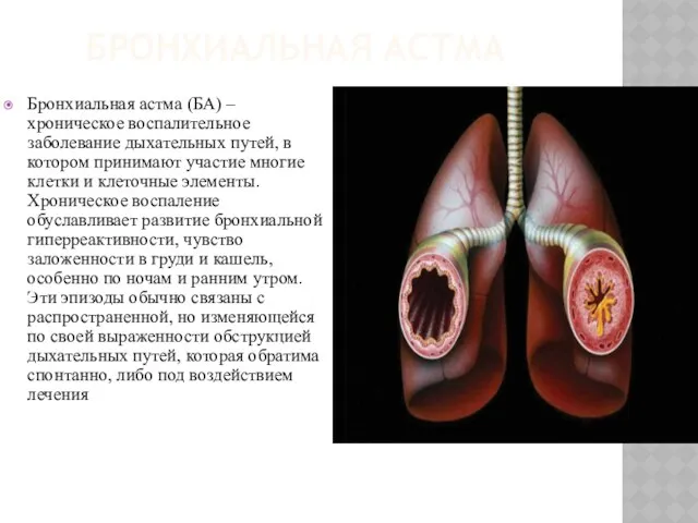 БРОНХИАЛЬНАЯ АСТМА Бронхиальная астма (БА) – хроническое воспалительное заболевание дыхательных