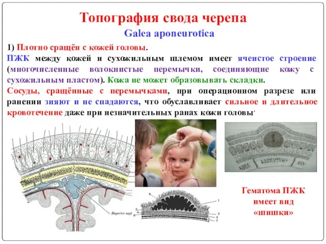 Топография свода черепа Galea aponeurotica 1) Плотно сращён с кожей головы. ПЖК между