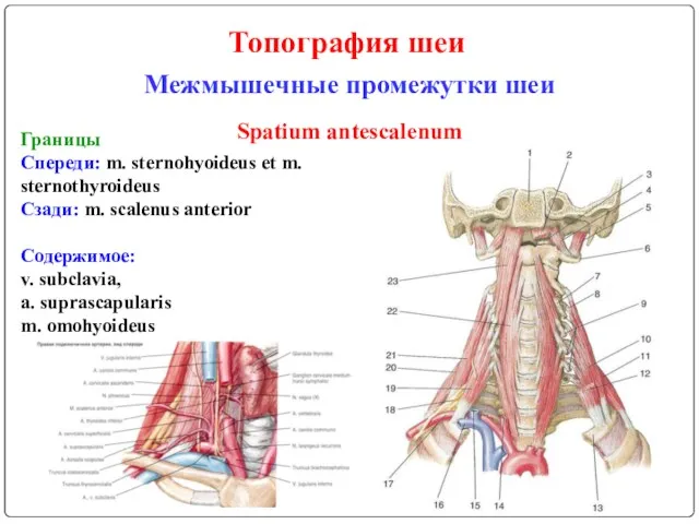 Топография шеи Межмышечные промежутки шеи Границы Спереди: m. sternohyoideus et m. sternothyroideus Сзади: