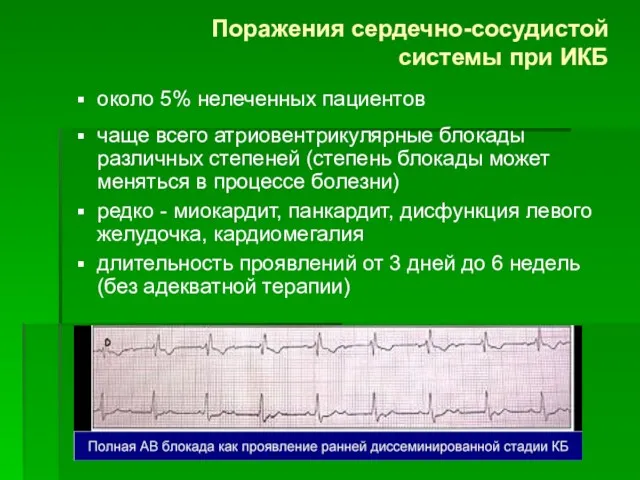 Поражения сердечно-сосудистой системы при ИКБ около 5% нелеченных пациентов чаще