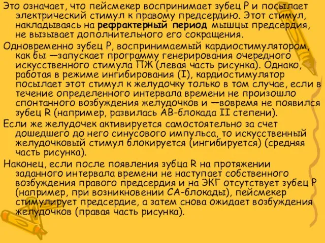 Это означает, что пейсмекер воспринимает зубец P и посылает электрический