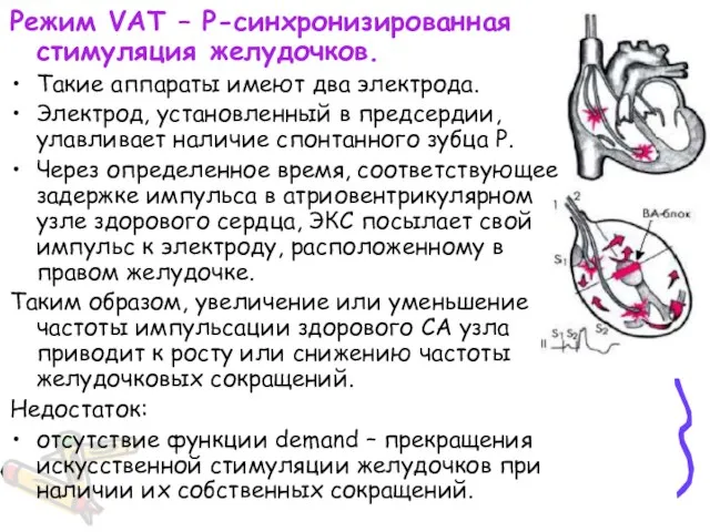 Режим VAT – Р-синхронизированная стимуляция желудочков. Такие аппараты имеют два