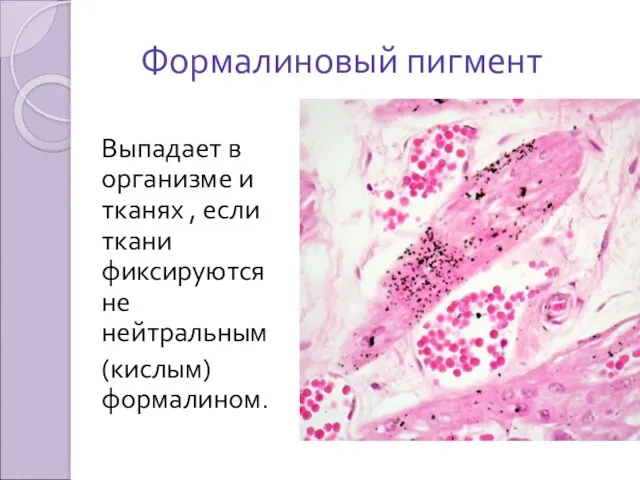 Формалиновый пигмент Выпадает в организме и тканях , если ткани фиксируются не нейтральным (кислым) формалином.