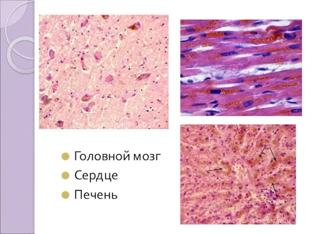 Головной мозг Сердце Печень