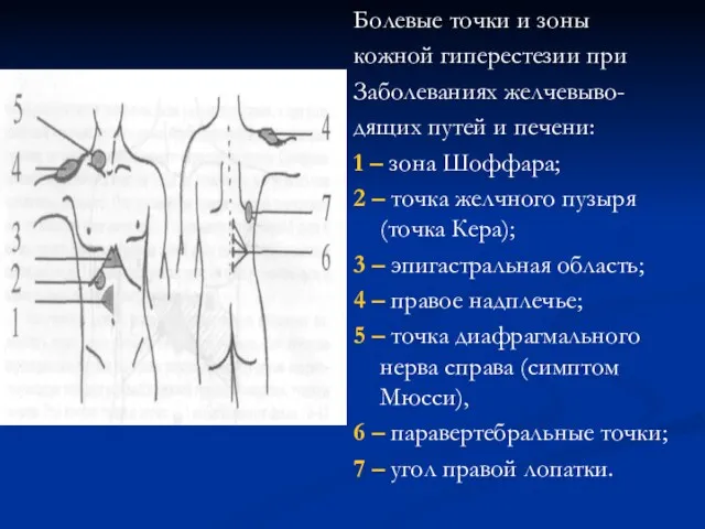 Болевые точки и зоны кожной гиперестезии при Заболеваниях желчевыво- дящих
