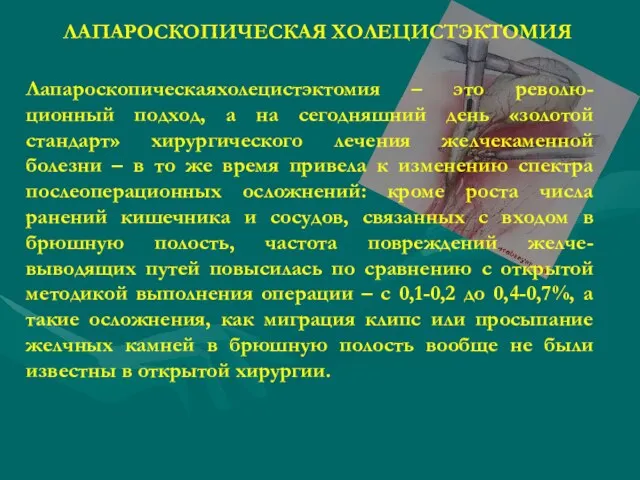 Лапароскопическаяхолецистэктомия – это револю-ционный подход, а на сегодняшний день «золотой