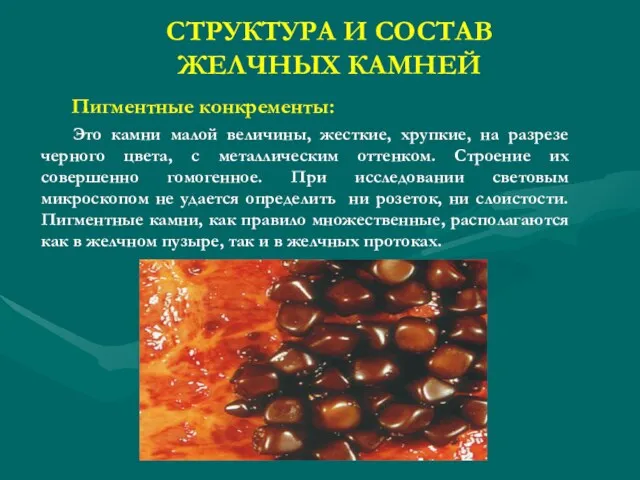 СТРУКТУРА И СОСТАВ ЖЕЛЧНЫХ КАМНЕЙ Пигментные конкременты: Это камни малой