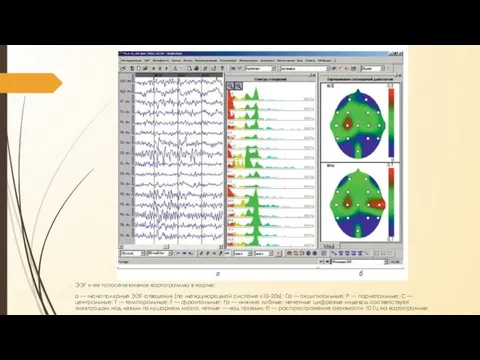 ЭЭГ и ее топоселективная картограмма в норме: а — монополярные