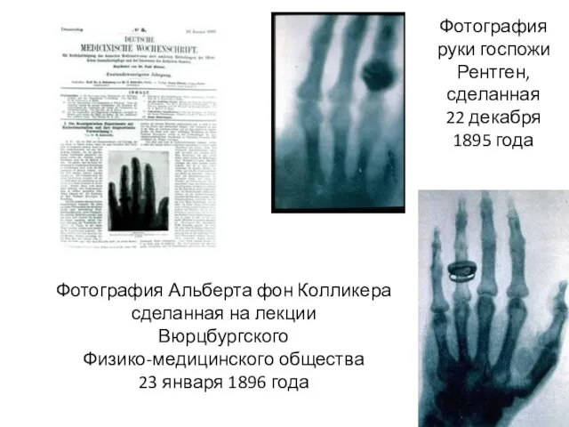 Фотография руки госпожи Рентген, сделанная 22 декабря 1895 года Фотография