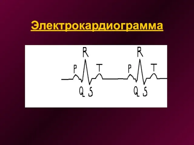 Электрокардиограмма