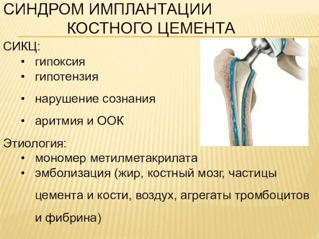 СИНДРОМ ИМПЛАНТАЦИИ КОСТНОГО ЦЕМЕНТА СИКЦ: гипоксия гипотензия нарушение сознания аритмия