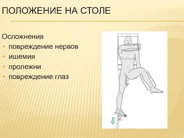 ПОЛОЖЕНИЕ НА СТОЛЕ Осложнения повреждение нервов ишемия пролежни повреждение глаз