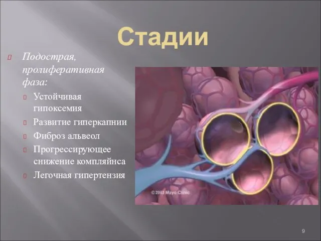 Стадии Подострая, пролиферативная фаза: Устойчивая гипоксемия Развитие гиперкапнии Фиброз альвеол Прогрессирующее снижение компляйнса Легочная гипертензия