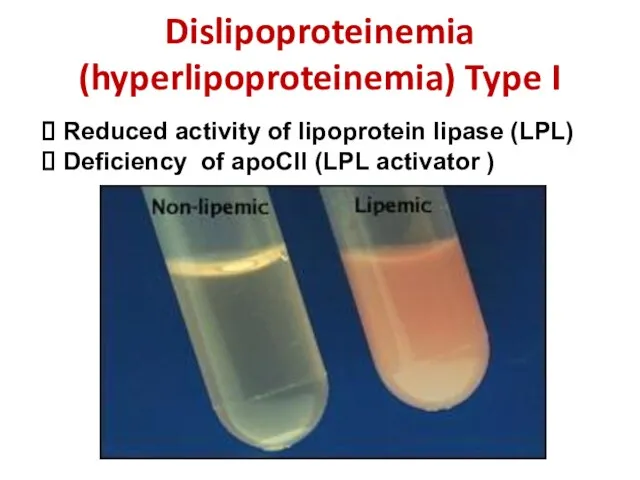 Dislipoproteinemia (hyperlipoproteinemia) Type I Reduced activity of lipoprotein lipase (LPL) Deficiency of apoCII (LPL activator )