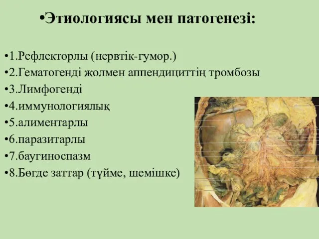 Этиологиясы мен патогенезі: 1.Рефлекторлы (нервтік-гумор.) 2.Гематогенді жолмен аппендициттің тромбозы 3.Лимфогенді