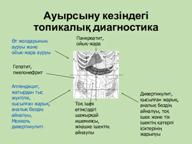 Ауырсыну кезіндегі топикалық диагностика Өт жолдарының ауруы және ойық-жара ауруы