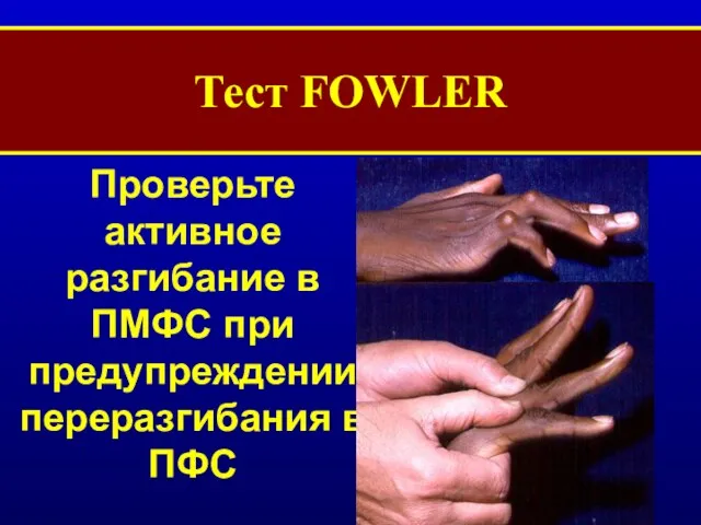 Тест FOWLER Проверьте активное разгибание в ПМФС при предупреждении переразгибания в ПФС