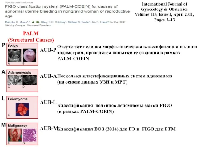 AUB-P AUB-A AUB-L AUB-M PALM (Structural Causes) International Journal of