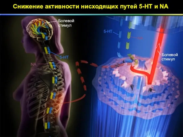 Снижение активности нисходящих путей 5-HT и NA Болевой стимул NA 5-HT 5-HT NA Болевой стимул