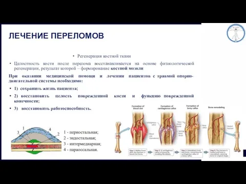 ЛЕЧЕНИЕ ПЕРЕЛОМОВ Регенерация костной ткани Целостность кости после перелома восстанавливается