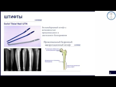 ШТИФТЫ Большеберцовый штифт с возможностью проксимального и дистального блокирования Проксимальный бедренный антиротационный штифт