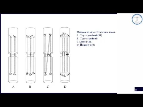 Многожильные Петлевые швы. A: Тсуге двойной(39) B: Тсуге тройной C: Лим (42), D. Йошизу (40)