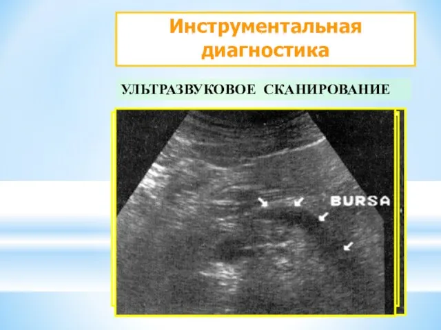 Инструментальная диагностика УЛЬТРАЗВУКОВОЕ СКАНИРОВАНИЕ