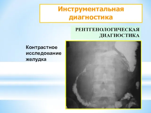 Инструментальная диагностика РЕНТГЕНОЛОГИЧЕСКАЯ ДИАГНОСТИКА Контрастное исследование желудка