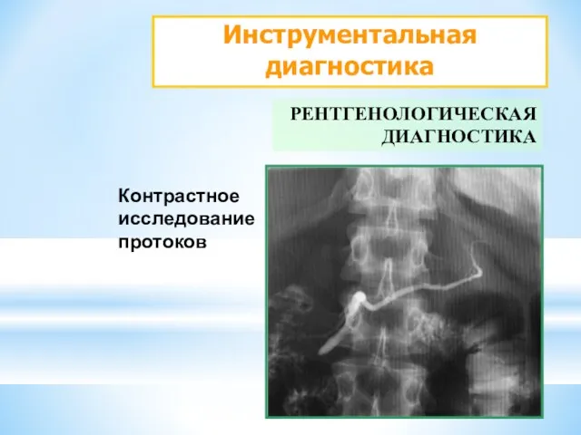 Инструментальная диагностика РЕНТГЕНОЛОГИЧЕСКАЯ ДИАГНОСТИКА Контрастное исследование протоков