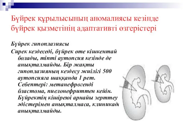 Бүйрек құрылысының аномалиясы кезінде бүйрек қызметінің адаптативті өзгерістері Бүйрек гипоплазиясы