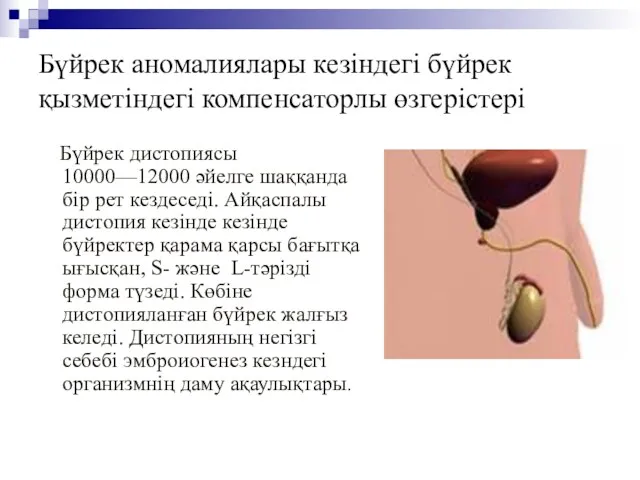 Бүйрек аномалиялары кезіндегі бүйрек қызметіндегі компенсаторлы өзгерістері Бүйрек дистопиясы 10000—12000