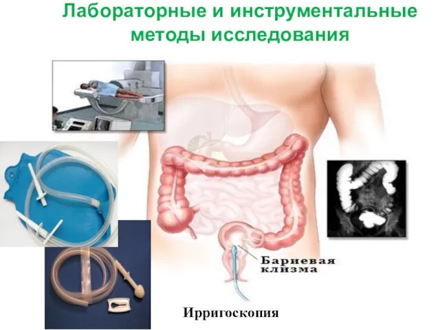 Лабораторные и инструментальные методы исследования Ирригоскопия