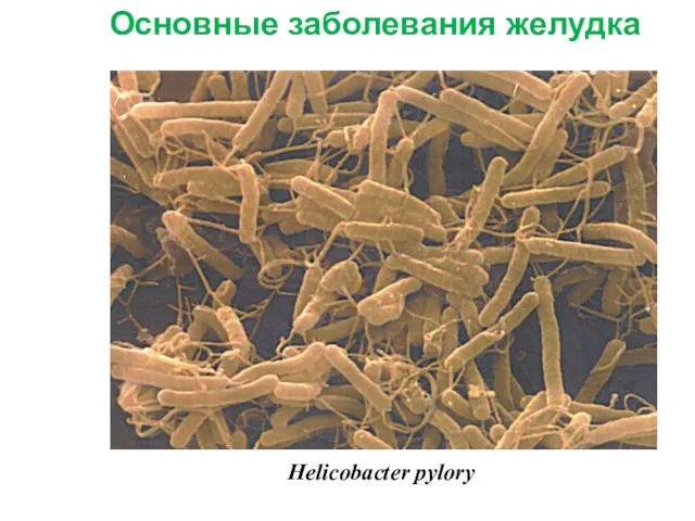 Основные заболевания желудка Helicobacter pylory