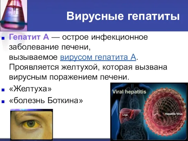 Вирусные гепатиты Гепатит А — острое инфекционное заболевание печени, вызываемое вирусом гепатита А.