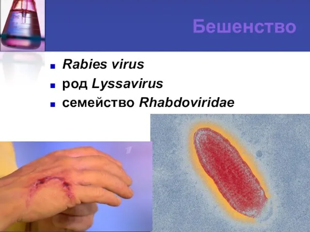 Бешенство Rabies virus род Lyssavirus семейство Rhabdoviridae