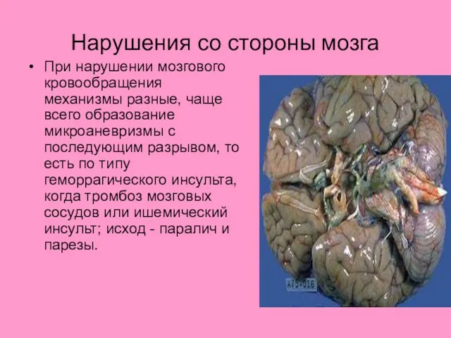 Нарушения со стороны мозга При нарушении мозгового кровообращения механизмы разные,