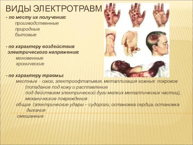 ВИДЫ ЭЛЕКТРОТРАВМ - по месту их получения: производственные природные бытовые