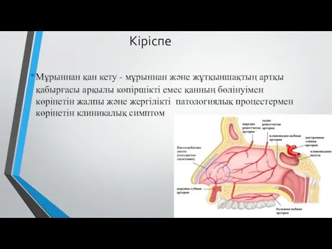 Кіріспе Мұрыннан қан кету - мұрыннан және жұтқыншақтың артқы қабырғасы