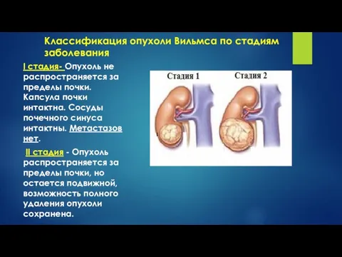 Классификация опухоли Вильмса по стадиям заболевания I стадия- Опухоль не