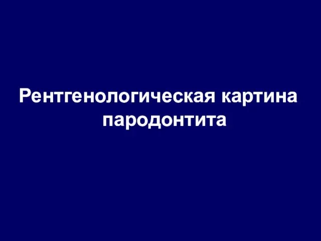 Рентгенологическая картина пародонтита