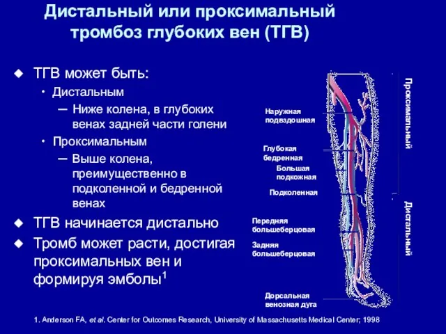 Дистальный или проксимальный тромбоз глубоких вен (ТГВ) ТГВ может быть: